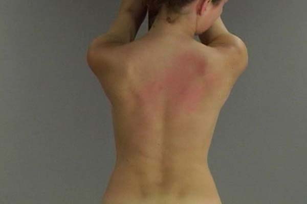 Her back is ablaze from the punishment - Unique Bondage - Pic 7