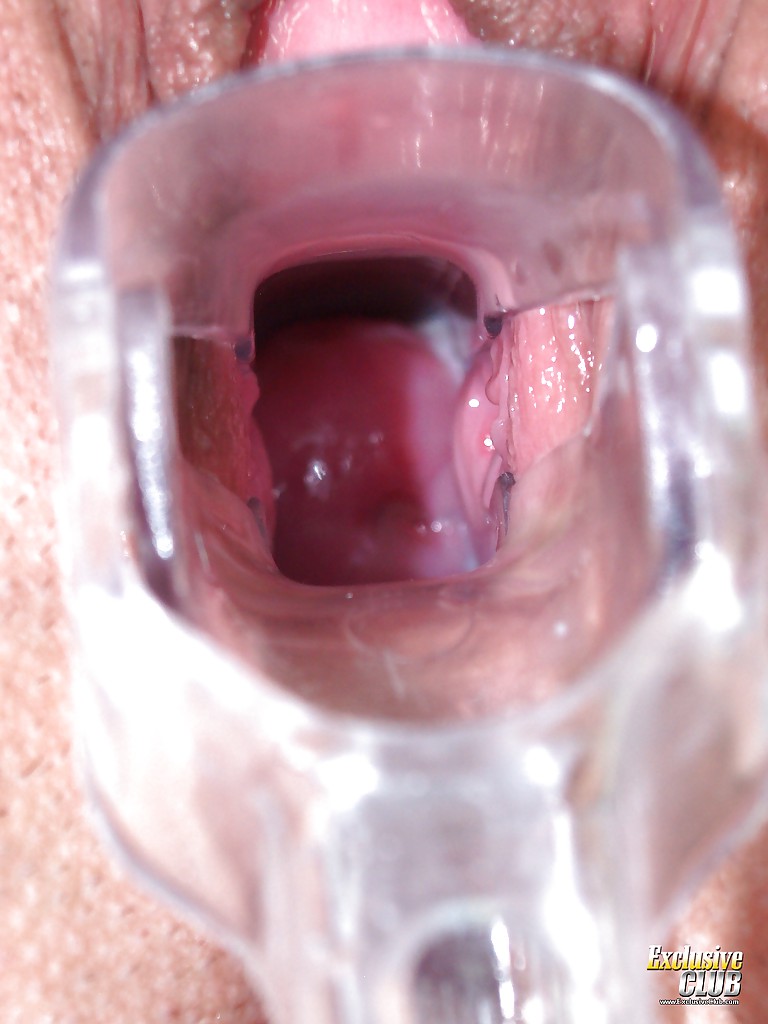 Czech wet exclusive club gyno - XXX Dessert - Picture 14