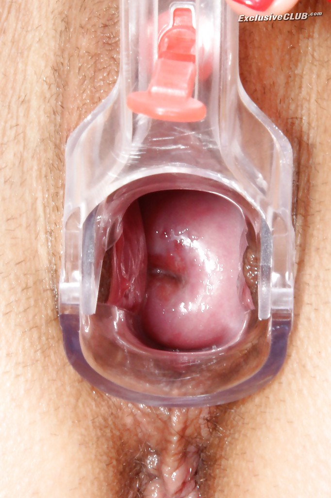 Busty exclusive club gyno - XXX Dessert - Picture 7