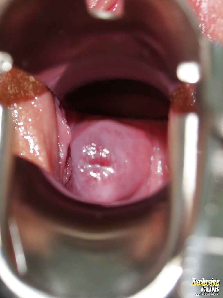 Pretty exclusive club gyno - XXX Dessert - Picture 14
