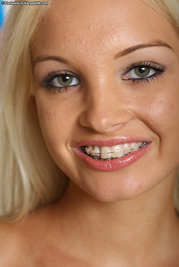 Beautiful blonde teen braces - XXX Dessert - Picture 15