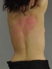 A young woman's red back bears testimony to - Unique Bondage - Pic 9