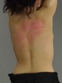 A young woman's red back bears testimony - Picture 9