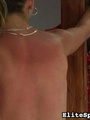 Reddened and painful, her back shows the - Picture 3
