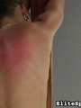Reddened and painful, her back shows the - Picture 14