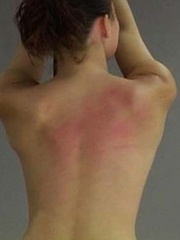 Her back is ablaze from the punishment - Unique Bondage - Pic 15