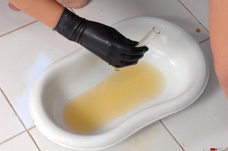 Collecting urine into specialized Pissing - Unique Bondage - Pic 10