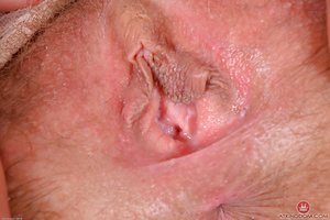 Mature clitoris