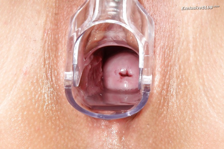 Czech brunette exclusive club gyno - XXX Dessert - Picture 10