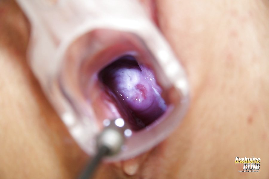 Czech hot exclusive club doctor - XXX Dessert - Picture 11