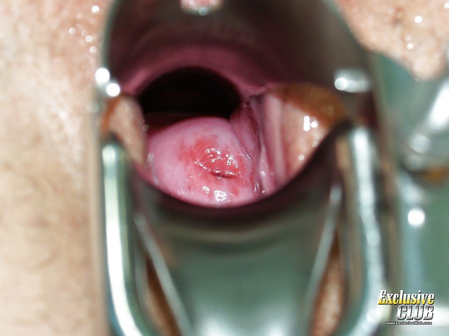 Skinny exclusive club doctor - XXX Dessert - Picture 11