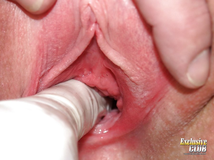 Anal exclusive club gyno - XXX Dessert - Picture 5