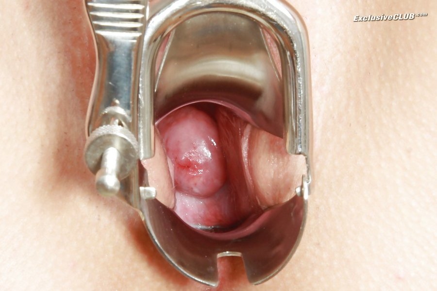 Czech brunette medical fetish - XXX Dessert - Picture 9