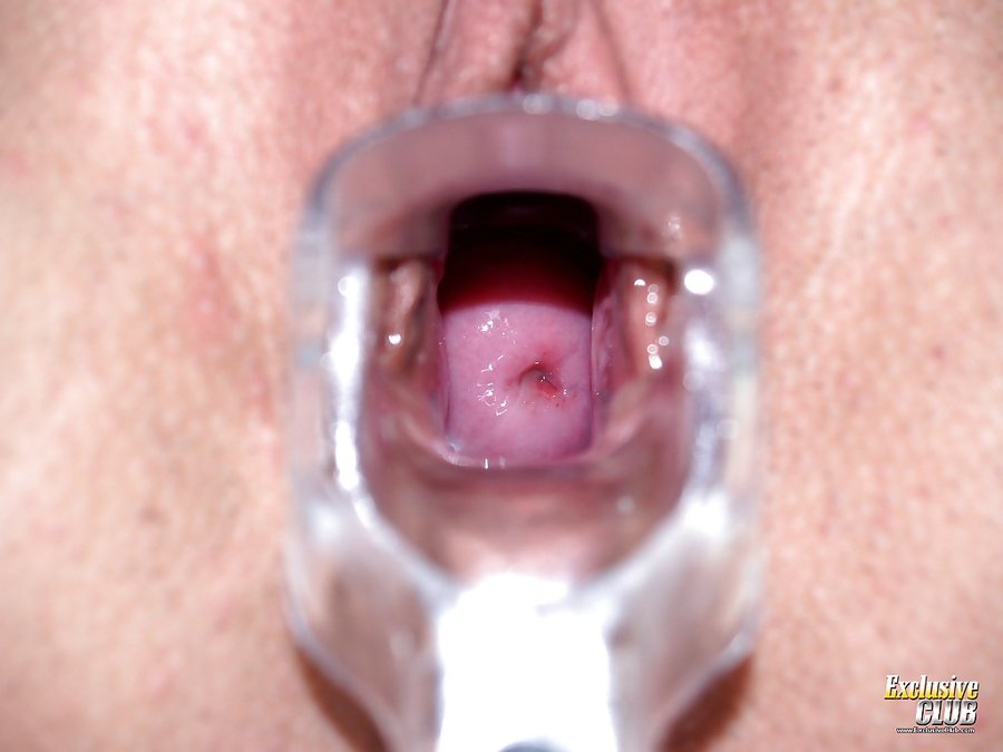 Czech wet exclusive club gyno - XXX Dessert - Picture 10