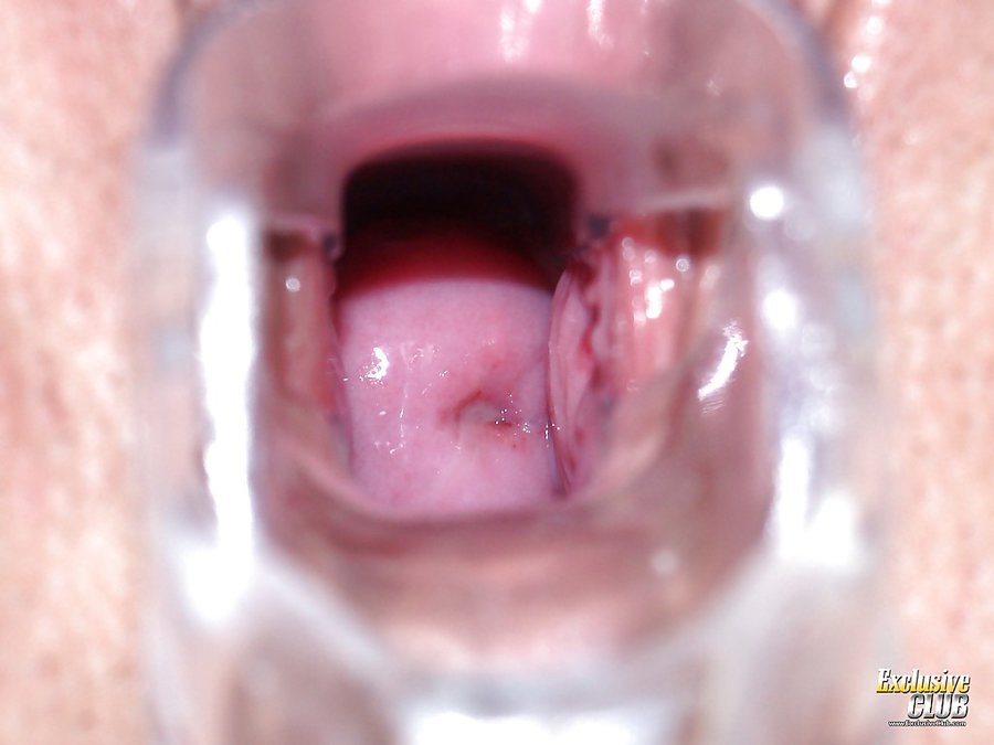 Czech wet exclusive club gyno - XXX Dessert - Picture 12