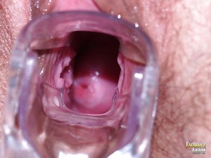 Czech small tits anal gyno - Picture 12