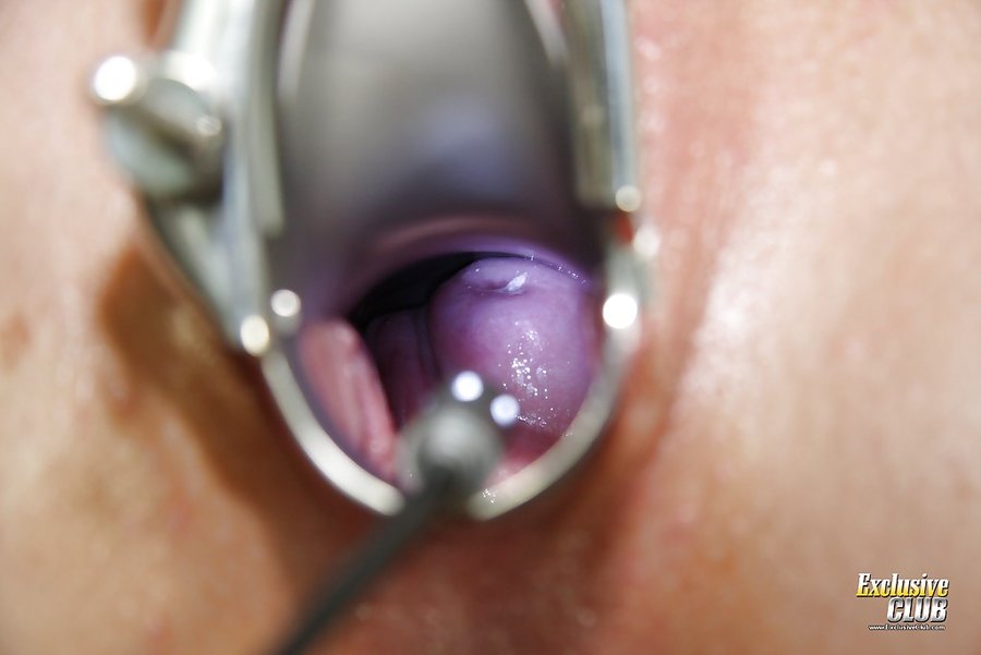 Czech gyno - XXX Dessert - Picture 14