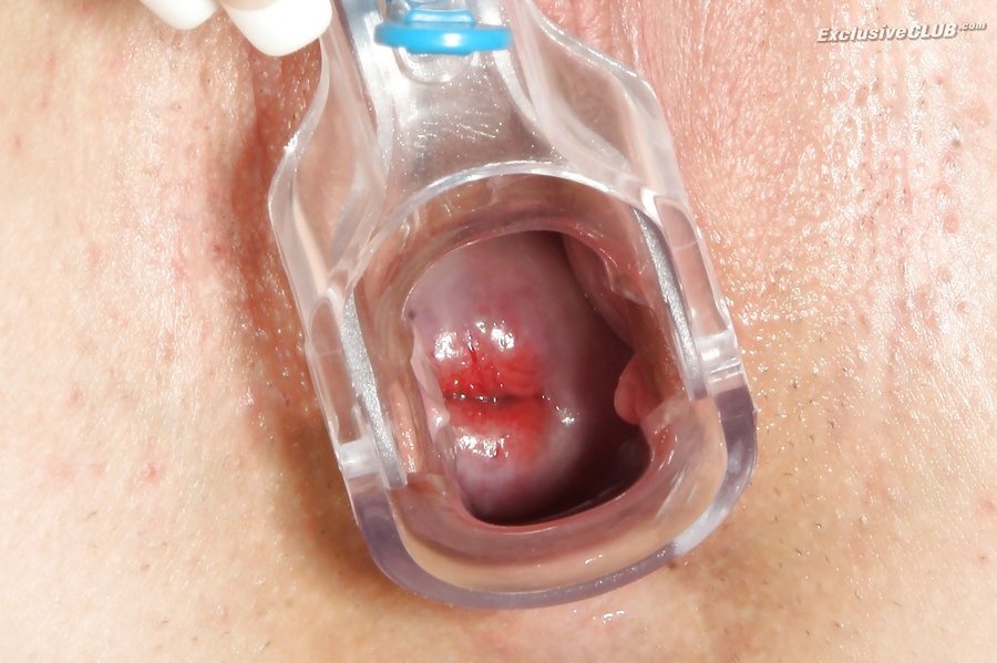 Slovak lovely exclusive club doctor - XXX Dessert - Picture 12