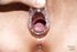 Slovak anal fetish