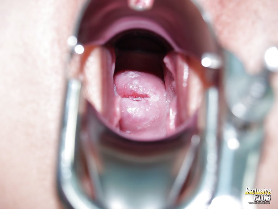 Hungarian uniform anal gyno - XXX Dessert - Picture 15