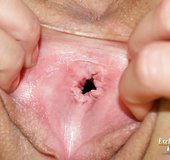 Vagina close up