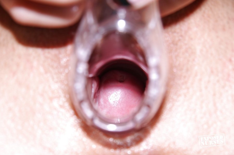 Slovak new vagina close up - XXX Dessert - Picture 15