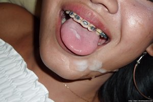 Tight braces