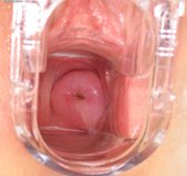 Wet speculum dildo