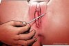 Skin piercing makes gagged slave wail. Dominus  By Aquila.
