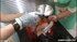Redhead is submitted to a kinky treatment by latex nurses
