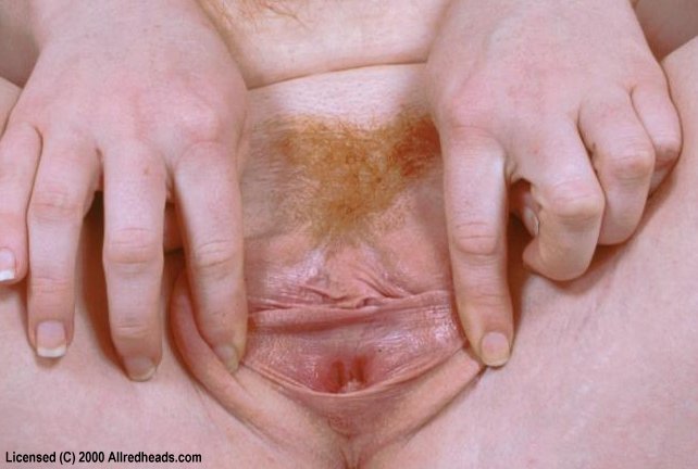 Sexy redhead. 16 Different Flaming Red Puss - XXX Dessert - Picture 13